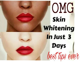 Top 10 Home Remedies to Get Milky White Skin just In 3 Days