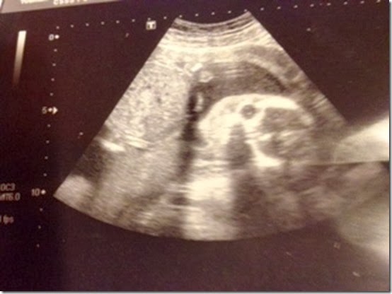ultrasound 2