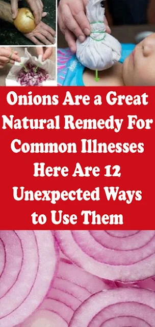 10 Illnesses That Can Be Cured By Onions