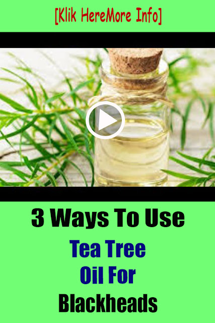 3 Ways To Use Tea Tree Oil For Blackheads