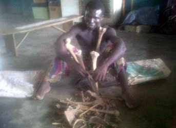 A suspected human parts seller