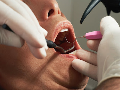 Trends You May Have Missed About Periodontal Disease Therapeutics Market