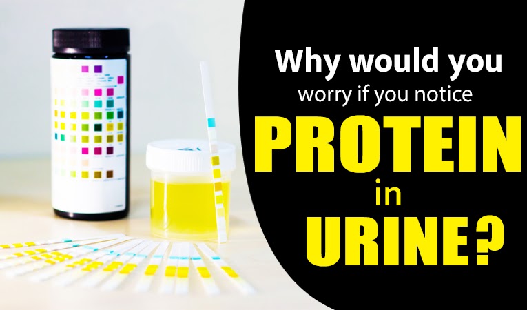 Why would you worry if you notice protein in urine?