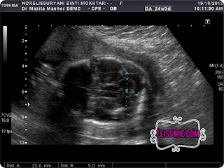 Detailed Scan Minggu 24 @ DEMC dan Scan 3D/4D tidak 