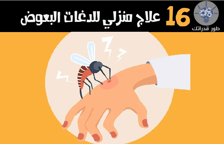 16 علاج منزلي للدغات البعوض