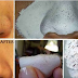 How To Remove Your Problem With Blackheads And Minimize Your Pores In Natural Way