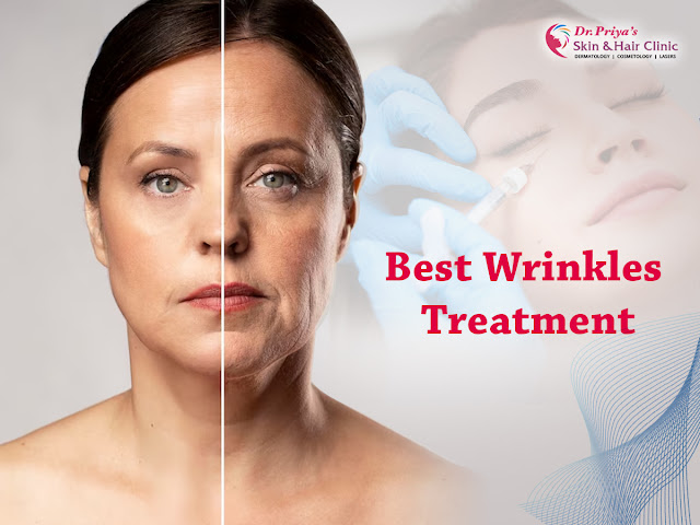 Best Wrinkles Treatment In Bangalore