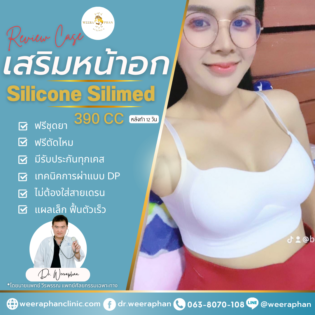 เสริมหน้าอก Silicone Silimed Advanced 385  cc