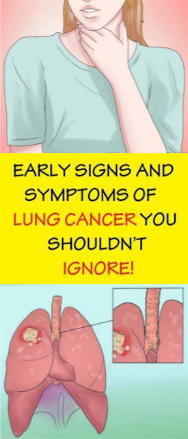 Early Warning Symptoms Of Lung Cancer You Shouldn’t Ignore
