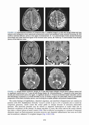 Magnetic Resonance Imaging of the Brain and Spine Fifth Edition