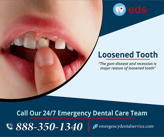 Loosened Tooth - Emergency Dental Service