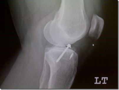 xray-2 2-25