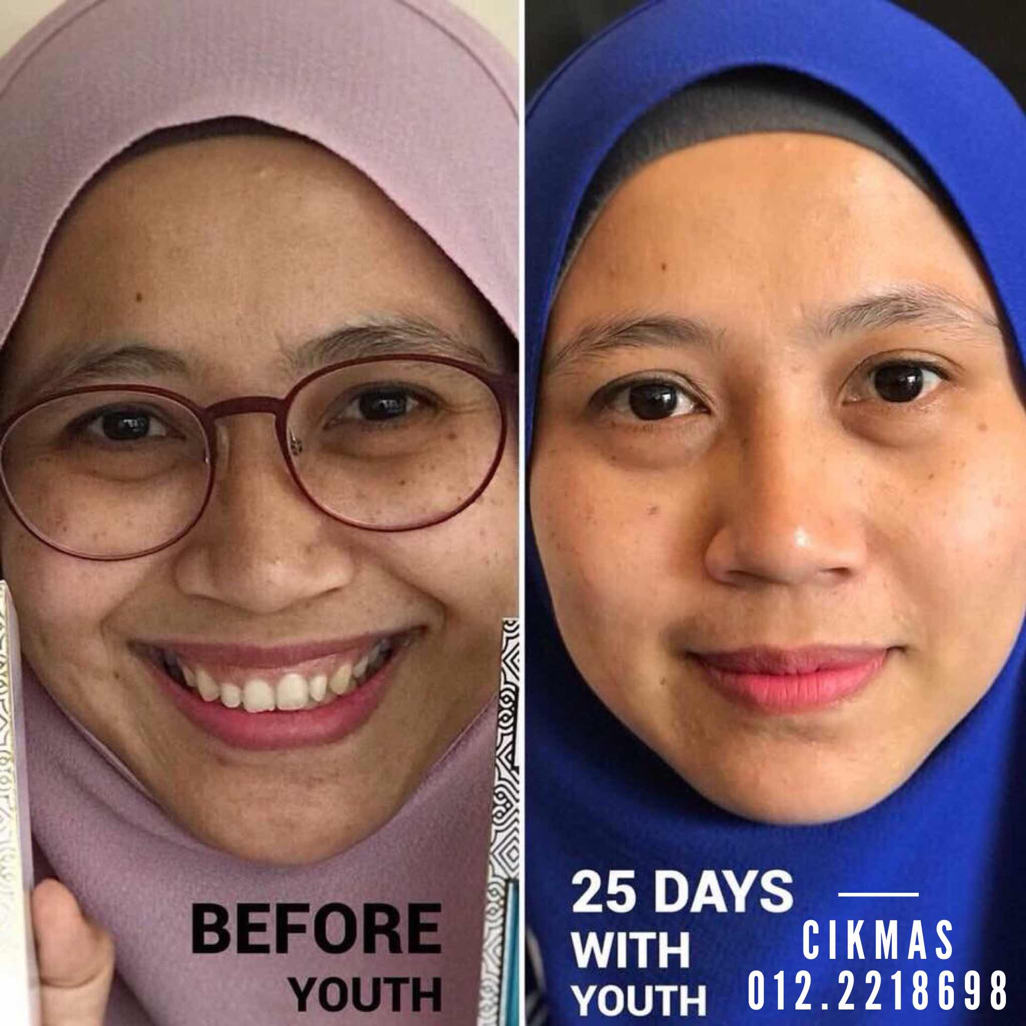 testimoni youth skincare