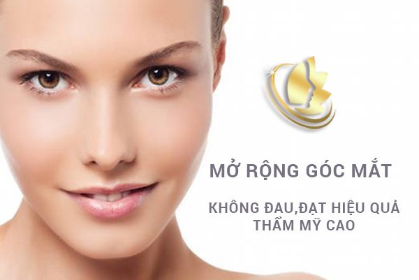 Mở rộng góc mắt không đau, đạt hiệu quả thẩm mỹ cao