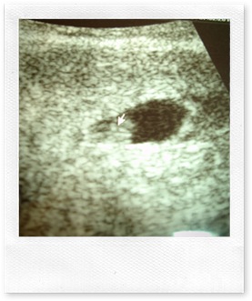 6_weeks_5_days_(4)