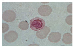 plasmodium vivax