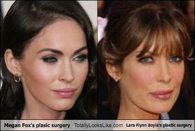 megan fox plastic surgery