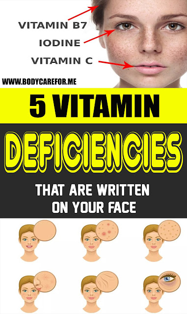 5 Vitamin Deficiency Signs That Show Up On Your Face