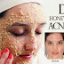 How To Get Rid Of Acne With Oatmeal - Home Remedies