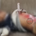 Jovem fica com faca cravada no peito após ser esfaqueado em Maringá