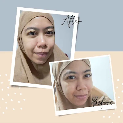 before-after-penggunaan-bio-hydro-moisture