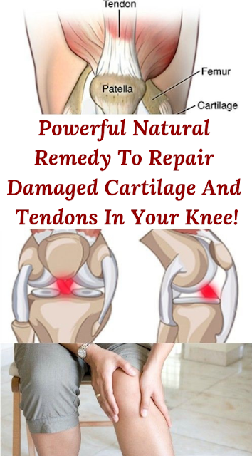 Powerful Natural Remedy To Repair Damaged Cartilage And Tendons In Your Knee!