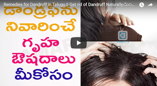 get rid of dandruff naturally