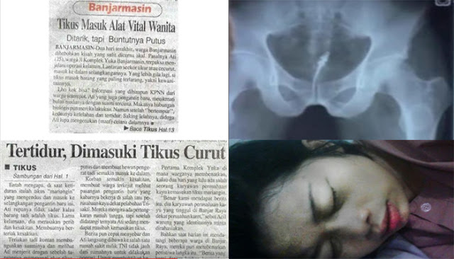 Banjarmasin - Tidur Tidak Pakai CD, Alat Vital Wanita Ini Dimasuki Tikus .