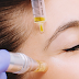 [The doctor warned skin vitamin] injection into a blood vessel May have a severe allergic reaction
