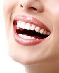 Dental Implants in Robina