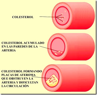 colesterol2