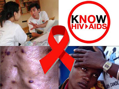 People With HIV / AIDS is Increasing | Healthy Living a Happy Life
