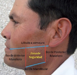 toxina botulinica botox tratamiento del bruxismo