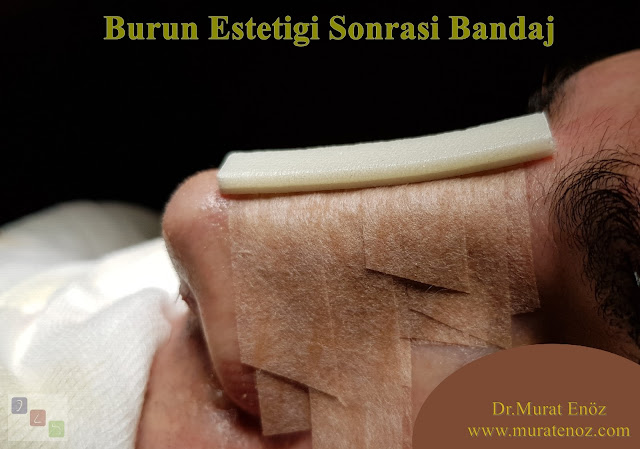 Burun Estetiği Sonrası Bandaj