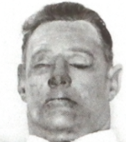 A Police photograph showing the face of the SOmerton Man which is believed to have been significantly altered