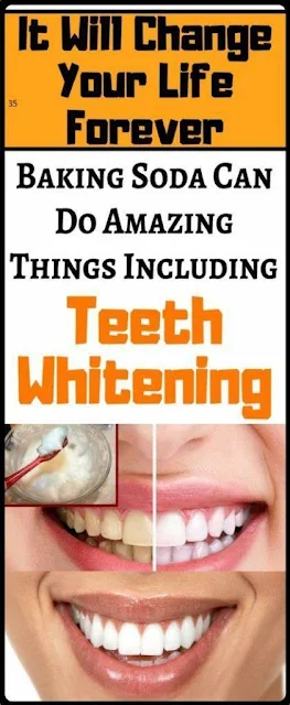 Teeth Whitening Baking Soda – Here’S What Happens To Your Body When You Use Baking Soda, It Will Change Your Life Forever