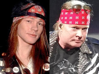 axl rose dulu dan sekarang