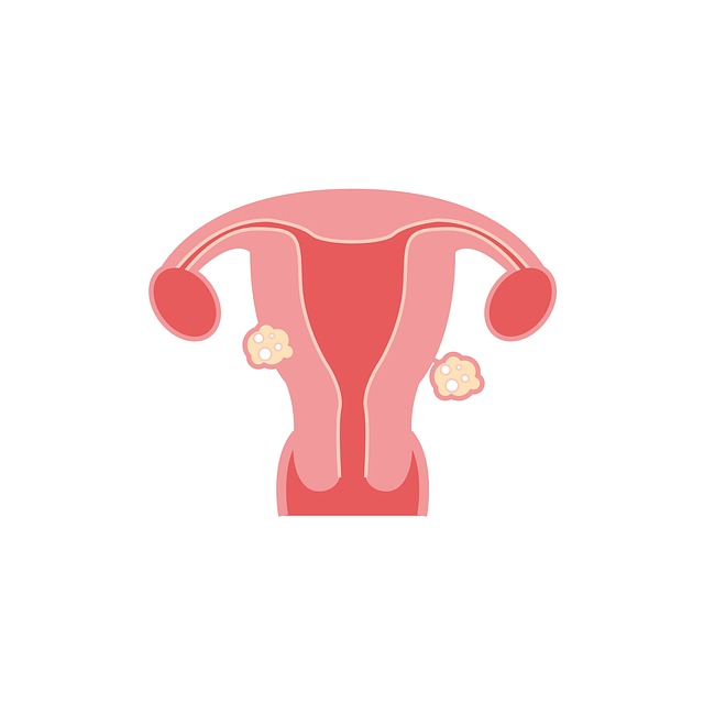 Causes of fibroids in the female reproductive system