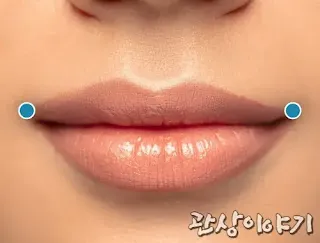 입꼬리에-있는-점