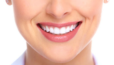  Bọc răng sứ có lợi ích gì
