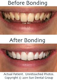 Arlington cosmetic dentist