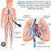 Pulmonary Embolism simptom darah beku berbahaya untuk ibu mengandung & bersalin