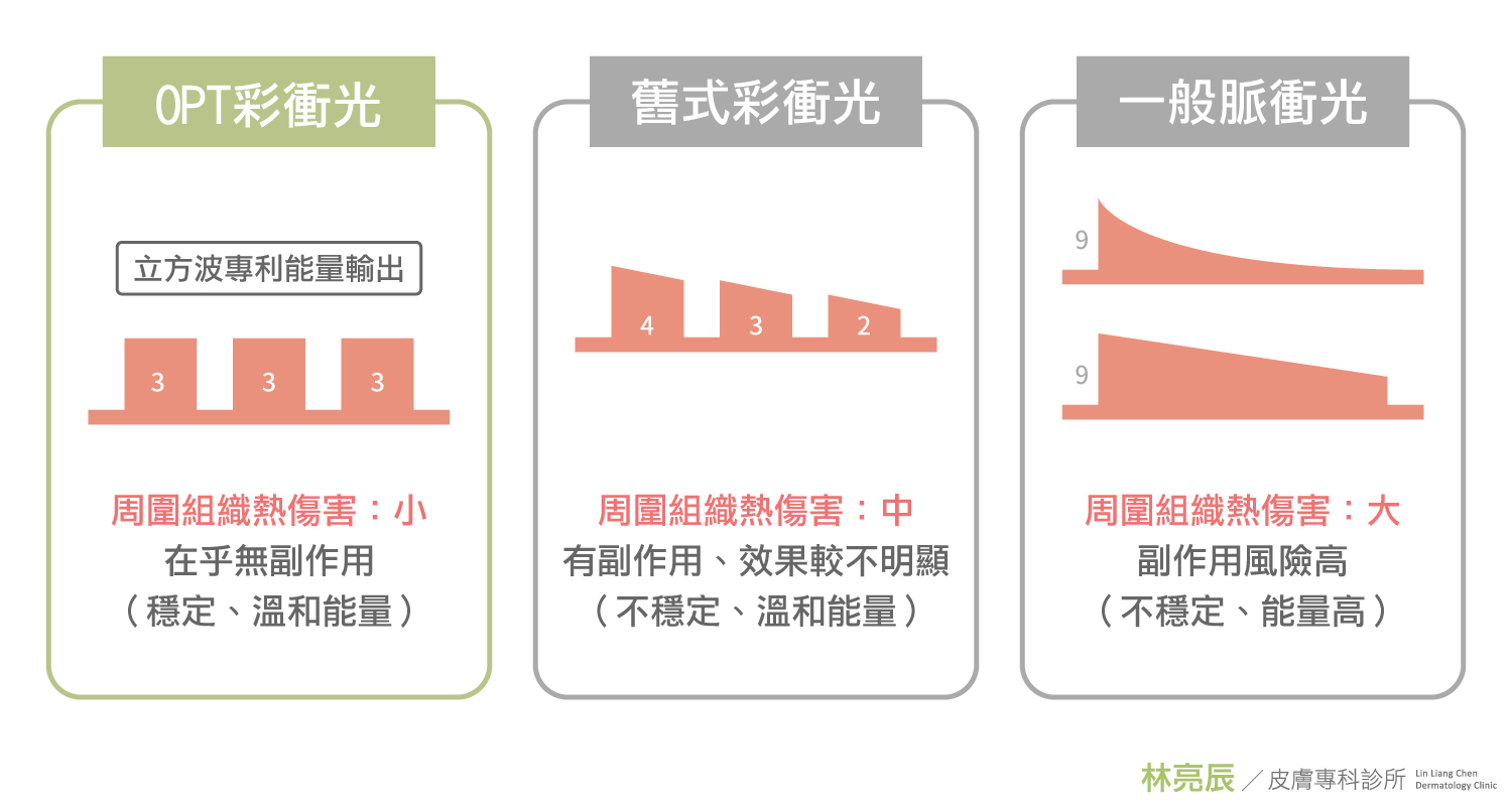 Stellar心動彩衝光的OPT立方波與傳統脈衝光相比較之下對周遭組織的熱傷害更小