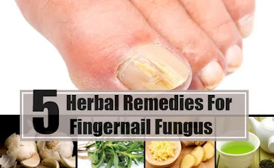 Top 5 Foods That Help Fight Nail Fungus Naturally