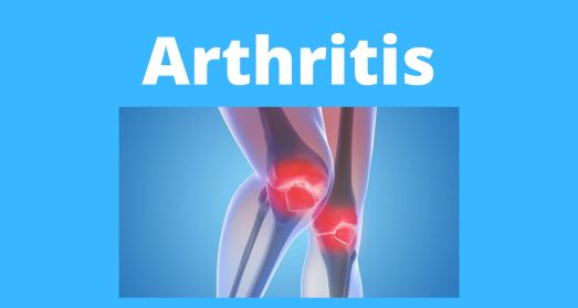 Arthritis: Symptoms, Causes & Treatment