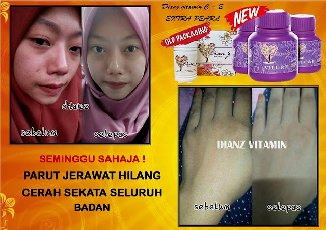 Dian Vitamin C & E Extra Pearl Murah (New Formula)