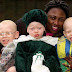 The Family is the key to help an Albino Child to Love Who They Are [Must Read]