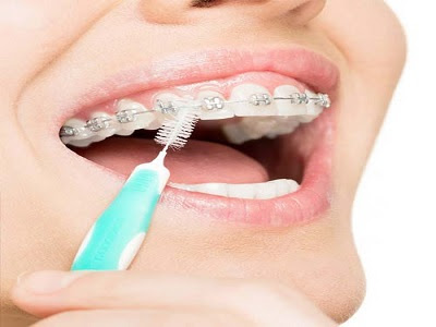 Interdental Cleansing Products Market - TechSci Research