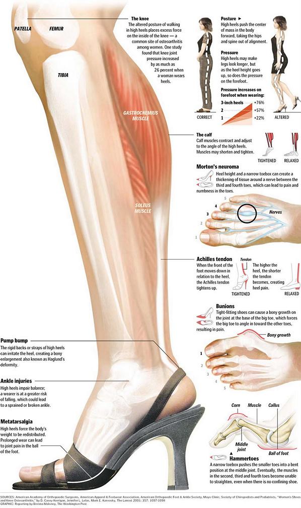 Hazards of wearing high-heeled shoes | Health Tips Box