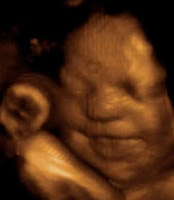 3d Ultra Sound2